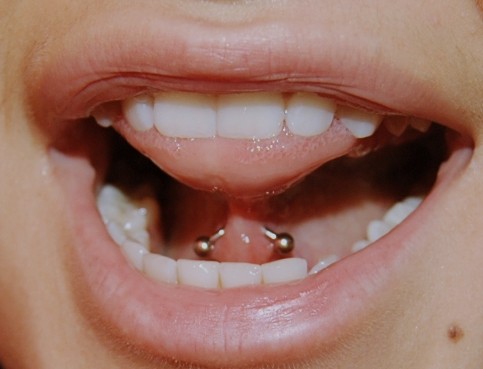 cuidados para piercing en el frenillo de la lengua