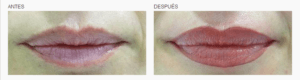 logia-barcelona-micropigmentación-labios-1
