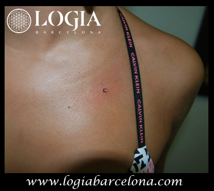 Piercings en el pecho microdermal Logia Barcelona