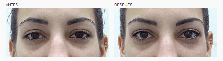 micropigmentacion ojos tatuaje linea de pestañas logia barcelona
